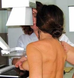[mamografia 5[4].jpg]