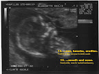 echo15aout_13.jpg