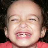 One Top Tooth