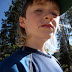Nicholas fell climbing over a log and scratched his face. Ouch! Nicholas fell climbing over a log and scratched his face. Ouch!
