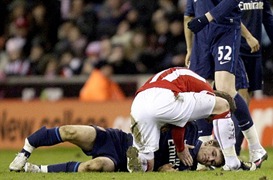 fractura de pierna de Ramsey