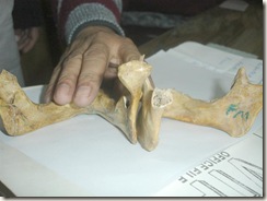 left male mandible with everted angle, heavier, more muscular markings, broader chin, opposite in right side mandible (female) 3