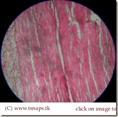 Dense regular connective tissue-Tendon histology slide Dense regular connective tissue-Tendon histology slide