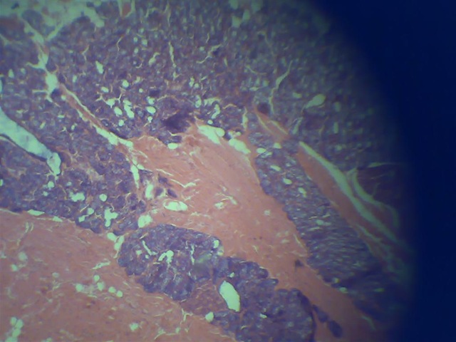 [histology slide under microscope[2].jpg]