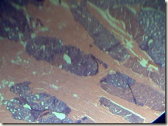 Mucous(purple) serous(pink) histology slide