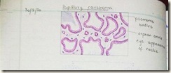papillary carcinoma diagram H&E