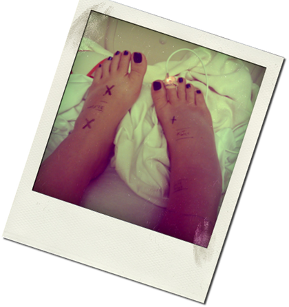 Bionic Beauty's snake bite and stay at Shands Hospital in Florida