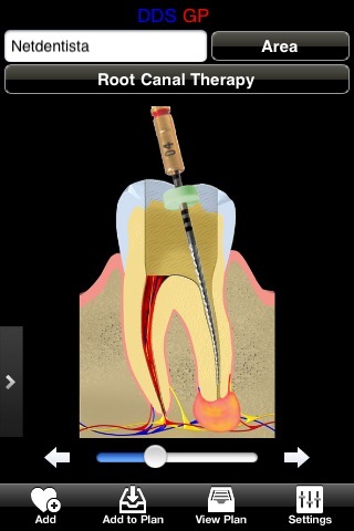 iphone dentista