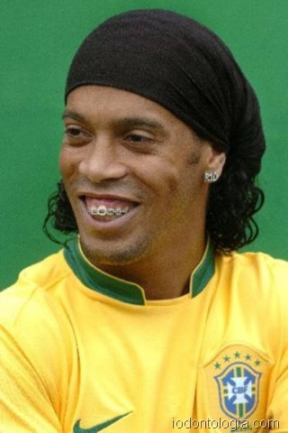 [famoso com aparelho[5].jpg]