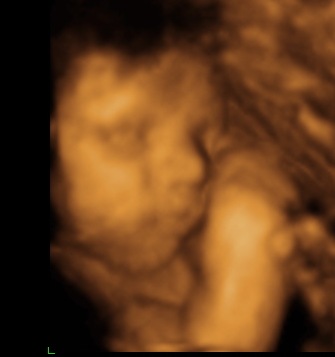 [BABY-BOY-4D-PICS_2_105.jpg]