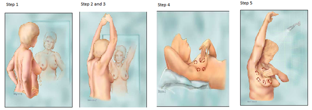 [breast exam[5].png]