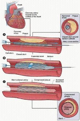 [arteria-spaghetto[6].jpg]