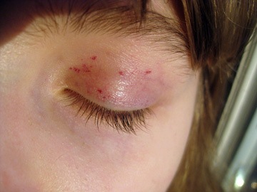 [JM-left-eye[4].jpg]