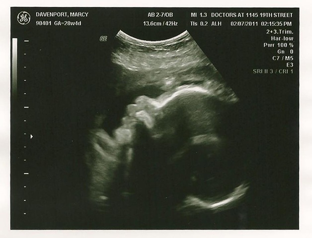 [baby 29 weeks 3[2].jpg]