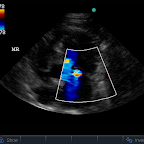 Mitral Regurgitation, Same Cat