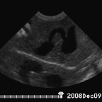 Intrhepatic Portosystemic Shunt in a Shih Tzu puppy