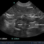 Pancreatic insulinoma in a 10yo crossbreed dog