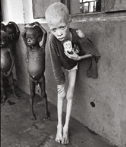 [Stop-the-starvation[8].jpg]