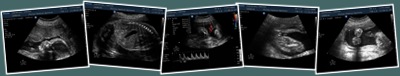 View detailed scan of littleone