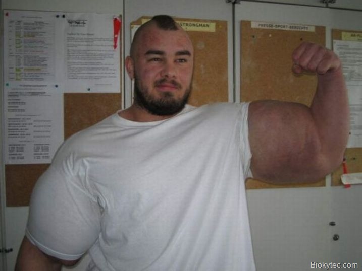 [Musculosquedanascowww.Biokytec.com2[1].jpg]