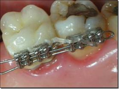clip_image006[4]