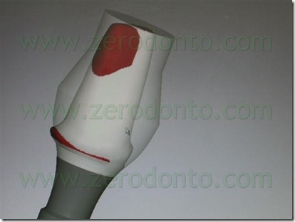 moncone etkon