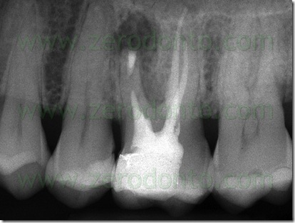 Fig. 39a Fig. 39a