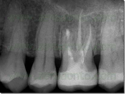 Fig. 39b Fig. 39b