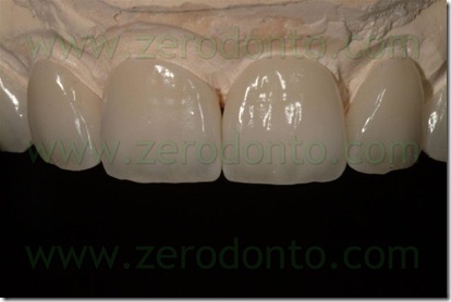 polishing ceramica