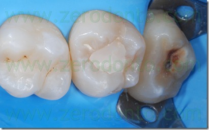 Fig0050Rosti Q2