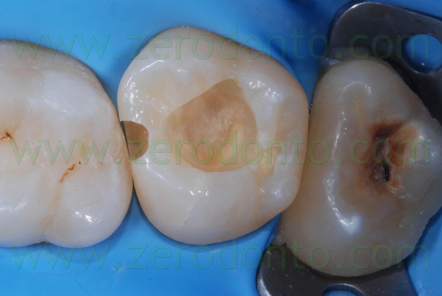 [Fig0052Rosti Q2[2].jpg]