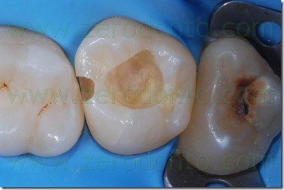 Fig0052Rosti Q2