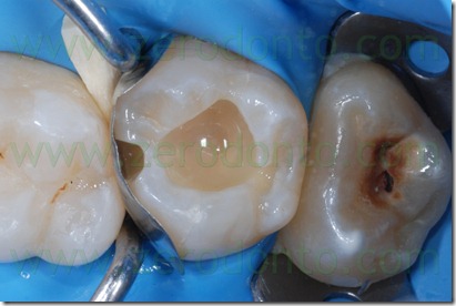 Fig0053Rosti Q2