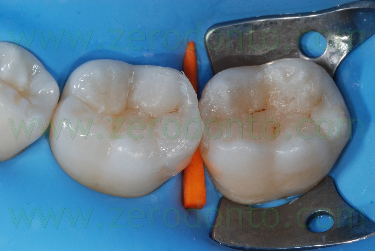 [Fig0091Rosti Q3[2].jpg]