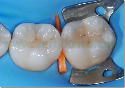 Fig0092Rosti Q3