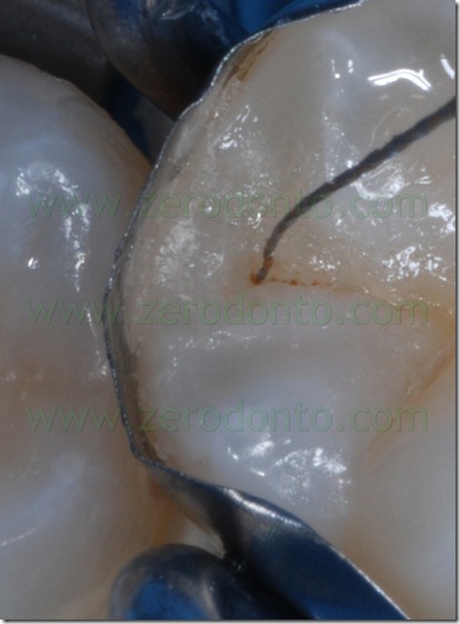 Fig0078Rosti Q4