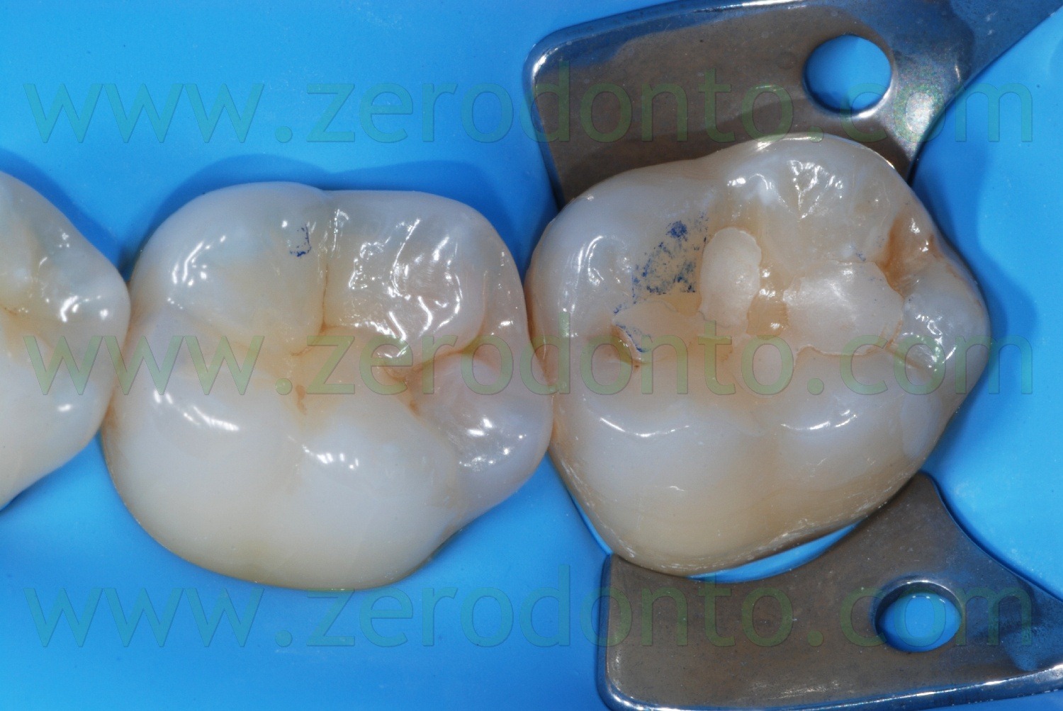 [Fig0083Rosti Q3[2].jpg]