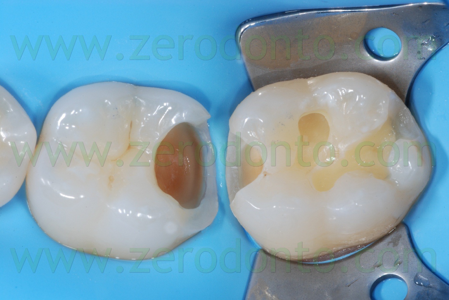 [Fig0084Rosti Q3[2].jpg]