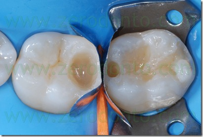 Fig0089Rosti Q3