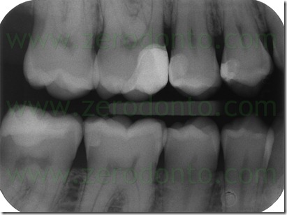 Fig0100Rosti fin
