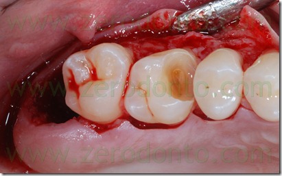 Fig0022Rosti Q1