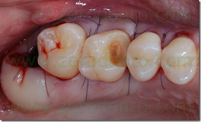 Fig0026Rosti Q1