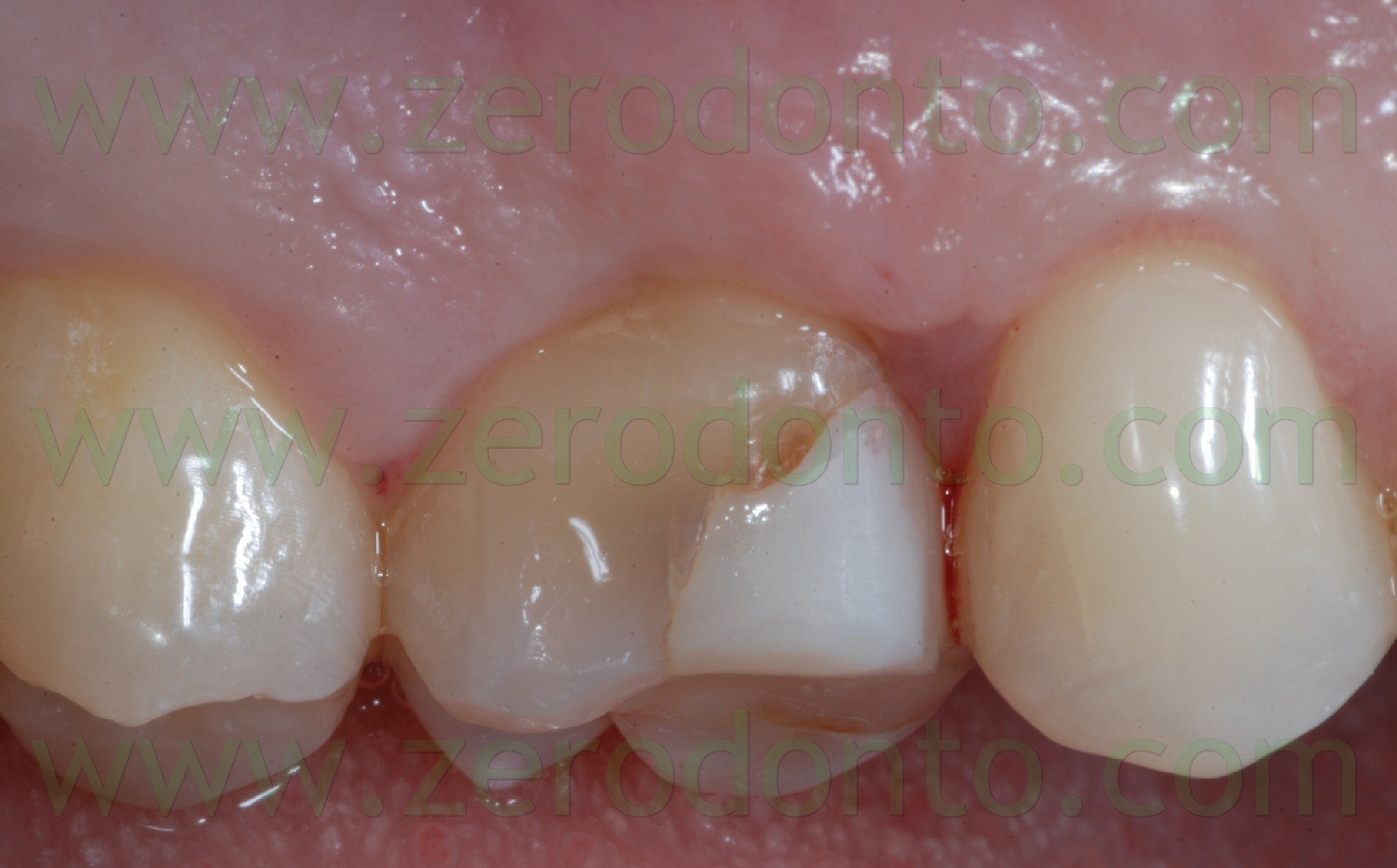 [Fig0016Rosti Q1[3].jpg]