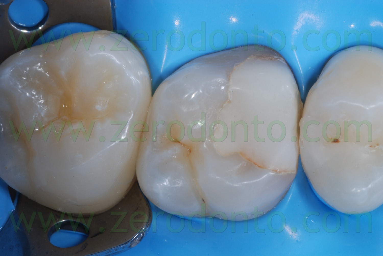 [Fig0017Rosti Q1[2].jpg]