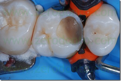 Fig0034Rosti Q1