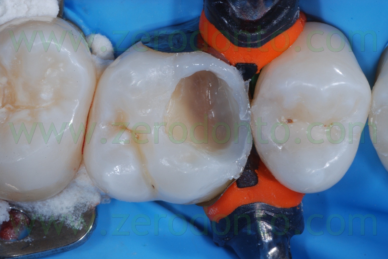 [Fig0035Rosti Q1[2].jpg]