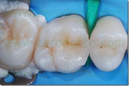 Fig0039Rosti Q1
