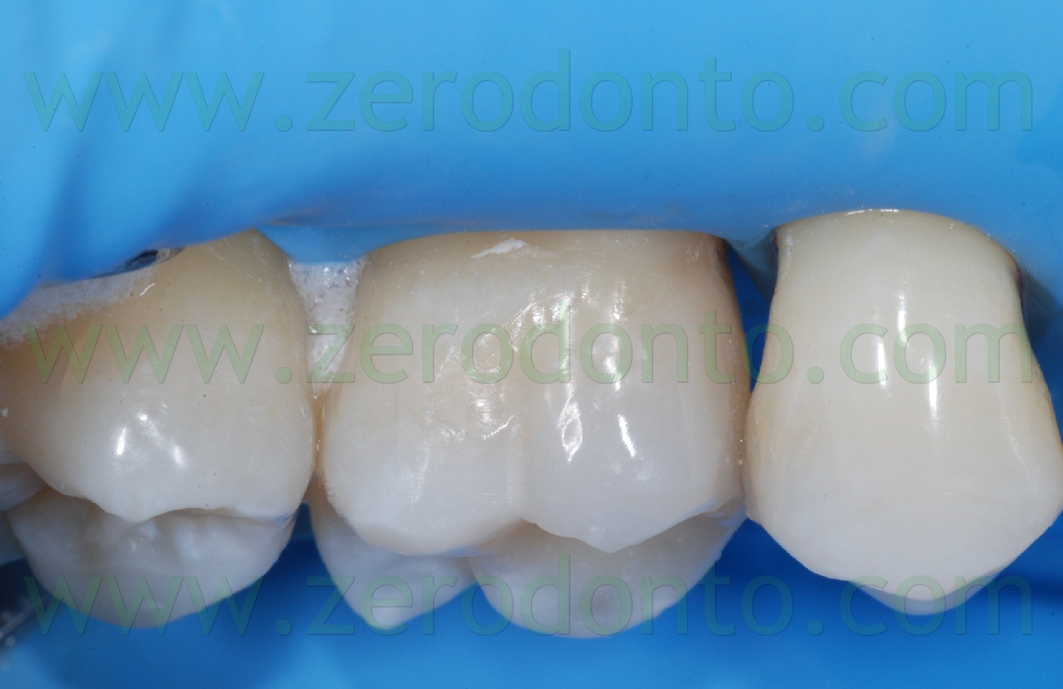 [Fig0040Rosti Q1[2].jpg]