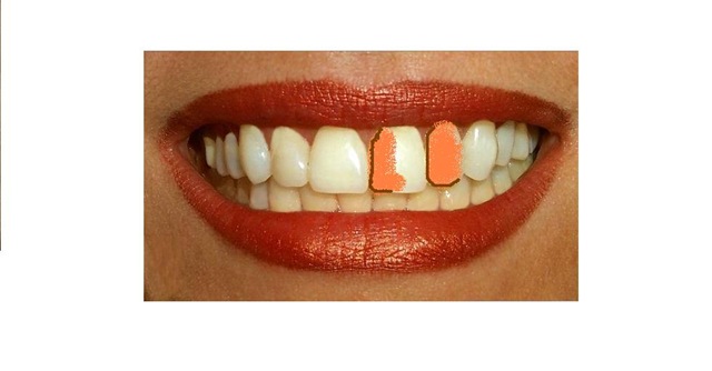 [teeth-stem-cells[2].jpg]