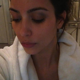 [Kim Kardashian Black Eye[3].png]
